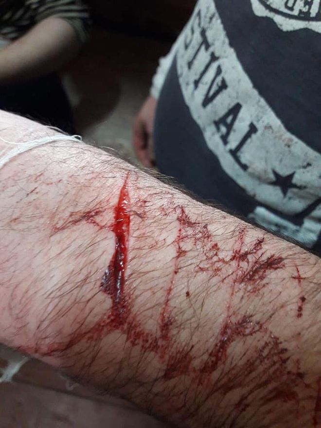 В СИЗО Черновцов заключенные порезали руки в знак протеста
