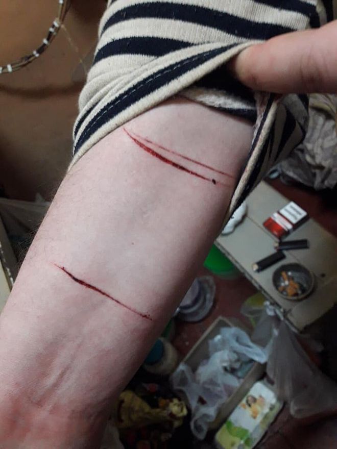 В СИЗО Черновцов заключенные нанесли себе раны в знак протеста