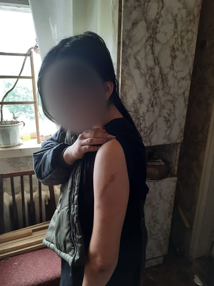 Девушка, пострадавшая от действий матери в Луганской области